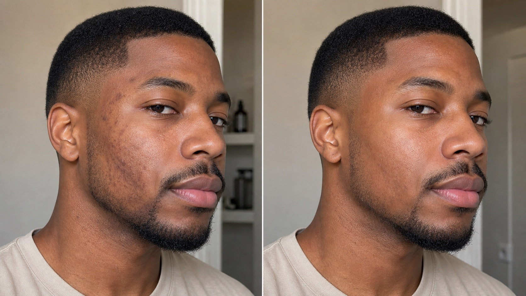 Before and after skincare progress for dark spot fading on Black skin