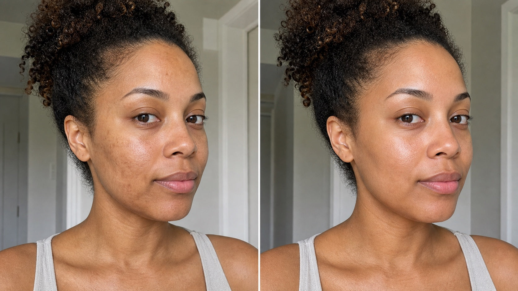Before and after skincare progress for a more even-looking skin tone